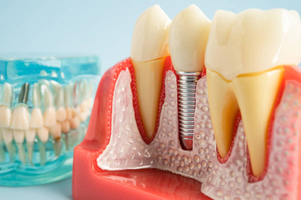 Best Periodontal (Gum) Disease Treatment  in Webster, SD